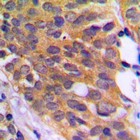 Anti-EEF2K (Phospho-S366) Antibody