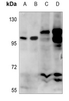 Alpha-adducin (Phospho-S726/713) Antibody