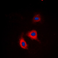 Alpha-adducin (phospho-S726/713) antibody