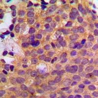 Anti-CK1 alpha Antibody