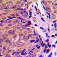 Anti-Ah Receptor (Phospho-S36) Antibody