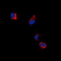Anti-EPHB1/2 (Phospho-Y594/604) Antibody