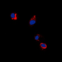 EPHB1/2 (phospho-Y594/604) antibody