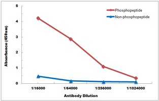 Anti-EPHB1/2 (Phospho-Y594/604) Antibody