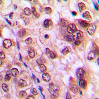 Anti-AKT Antibody
