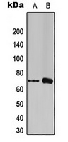 FOXC1/2 Rabbit Polyclonal Antibody