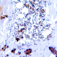 Anti-SMAD2/3 (Phospho-T8) Antibody