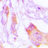 Anti-MARK Antibody
