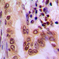 Anti-AMPK alpha 1/2 (Phospho-T183/172) Antibody