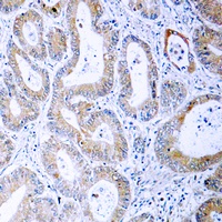 Anti-MKK1/2 (Phospho-S222/226) Antibody