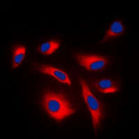 Anti-MKK1/2 (Phospho-S222/226) Antibody