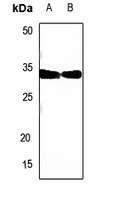 SIAH1/2 Antibody
