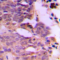 SIAH1/2 antibody