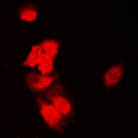 SIAH1/2 antibody