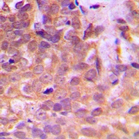 STAT5 antibody