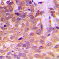 STAT5 Antibody