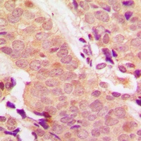 Anti-STAT5 (Phospho-Y694/699) Antibody