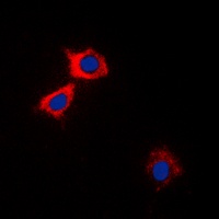 CaMK2 alpha/delta antibody