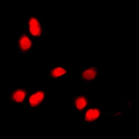 Histone H3 (phospho-T11) antibody