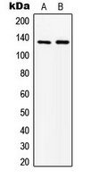 ABL1 Rabbit Polyclonal Antibody