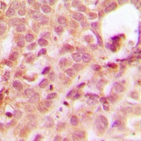 ABL1 Rabbit Polyclonal Antibody