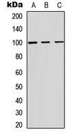 ADAM12 Rabbit Polyclonal Antibody