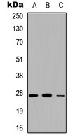 Adipsin Rabbit Polyclonal Antibody