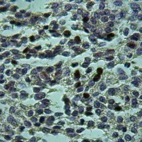 Anti-AF3P21 Antibody