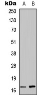 ANG Rabbit Polyclonal Antibody