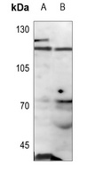 ANKRD20A1 Antibody