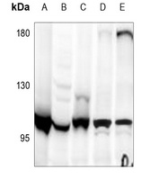 Apolipoprotein B Receptor Antibody