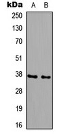 B3GALT6 Antibody