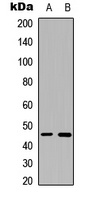 B4GALT6 Antibody