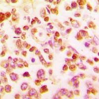 BCL6 Antibody