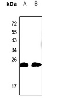 CABP2 Antibody