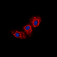 Cadherin 23 antibody