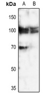 Calpain 3 Antibody
