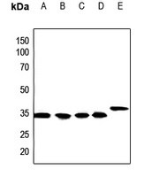 Calponin 1 Antibody