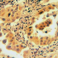 Anti-Calponin 1 Antibody