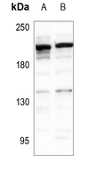 Carboxypeptidase D Antibody