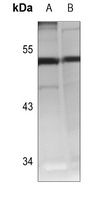 Cathepsin A 20k Rabbit Polyclonal Antibody