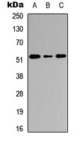 Cathepsin C HC Antibody