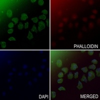 Cathepsin K antibody