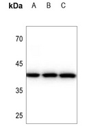 Cathepsin L HC Antibody