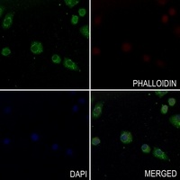 Anti-CATSPER1 Antibody