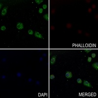 CATSPER1 antibody