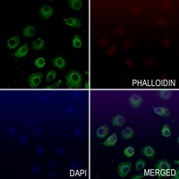 CD156a Rabbit Polyclonal Antibody