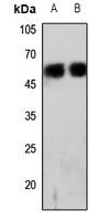 CD224 HC Rabbit Polyclonal Antibody