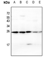 CD269 Rabbit Polyclonal Antibody