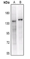 CD41 HC Rabbit Polyclonal Antibody
